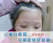 儿童白癜风的发病原因有哪些?