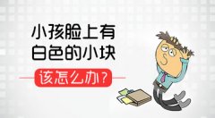 小儿白癜风治疗需注意什么
